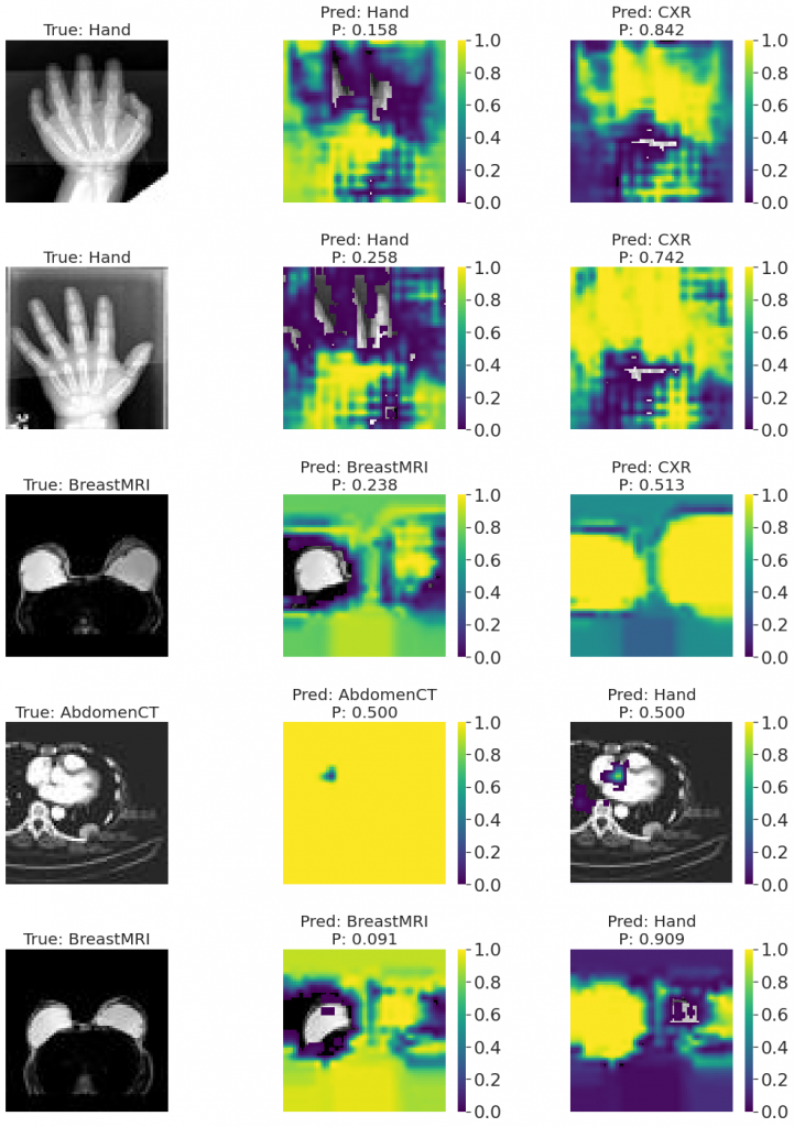 Occlusion sensitivity dla pomyłek najlepszego modelu trenowanego na generatorze obrazów