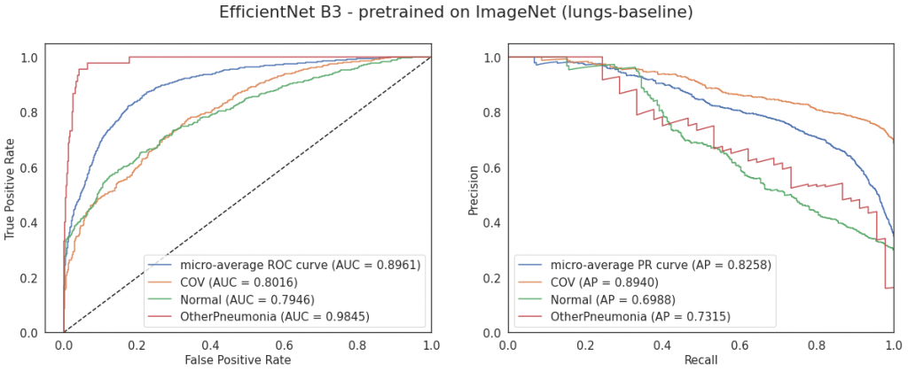 Krzywe ROC i PR dla modelu EfficientNet B3 pretrained on ImageNet (konfiguracja lungs-baseline)
