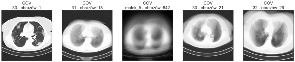 Średnie obrazy poszczególnych katalogów klasy COV - zbiór walidacyjny